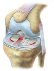 King Brand Coldcure Provides Relief of Pain and Swelling on Knee Injuries King Brand Coldcure Provides Relief of Pain and Swelling on Knee Injuries